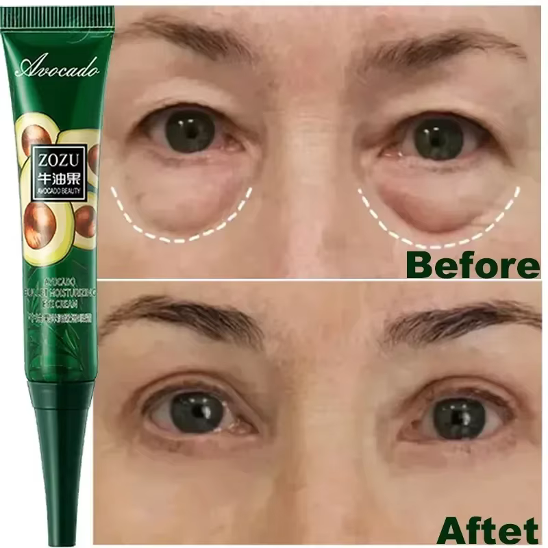 Crème pour les yeux, élimine les cernes