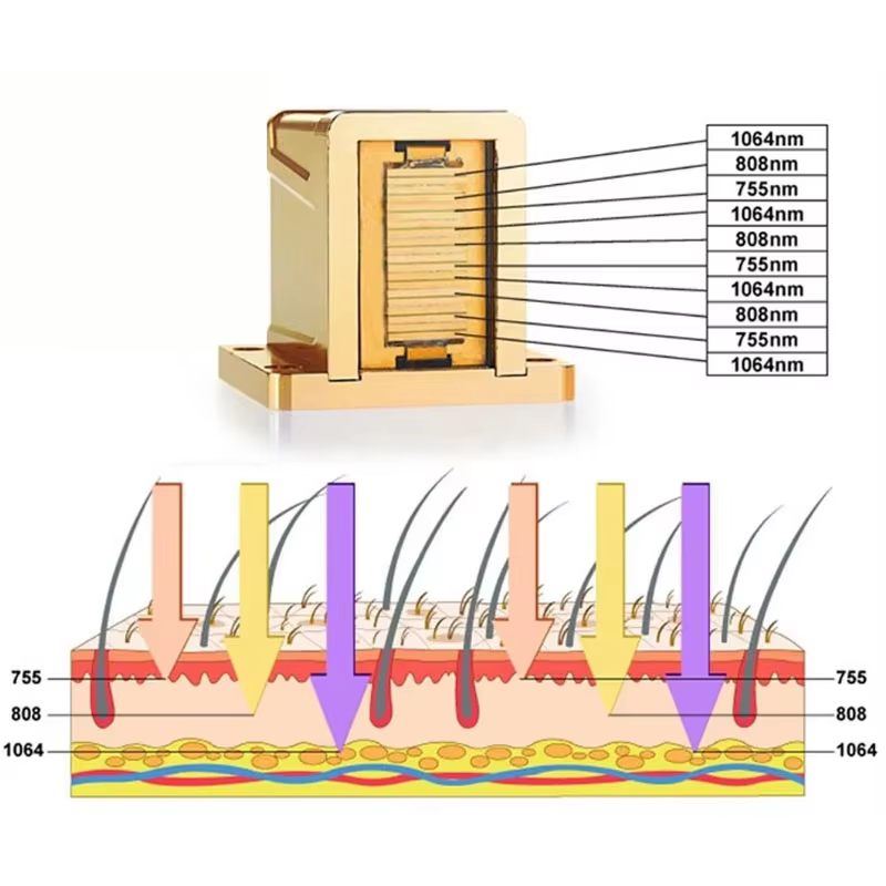 Module laser série LST pour épilation définitive 5/6/8/10/12/16 barres Puissance : 250/300/400/600/800W Pièces détachées pour appareil de beauté