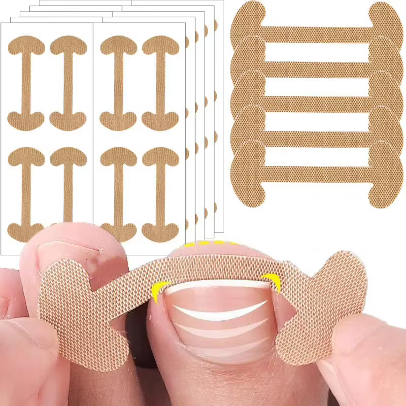 Patch adhésif pour ongles incarnés (5/10/20/30 feuilles) – Autocollant correcteur d'ongles