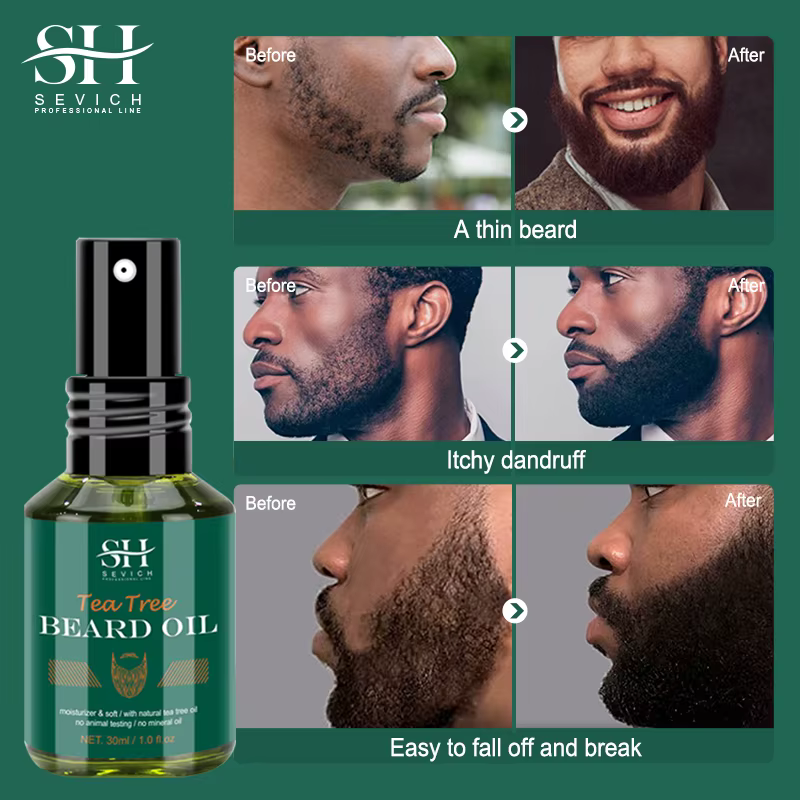 SEVICH huile de barbe de croissance pour hommes soin de garniture de style hydratant plus épais favoriser la repousse