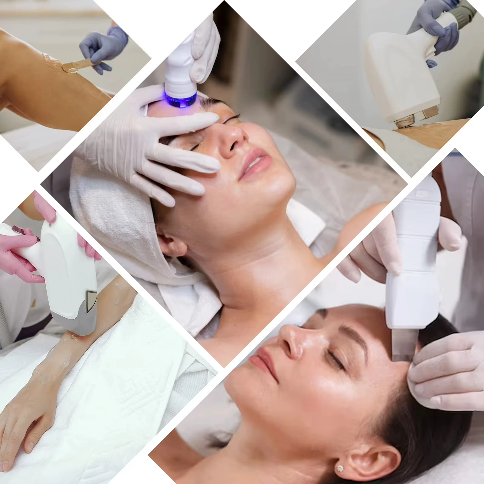 Crème d'épilation au Gel frais de congélation