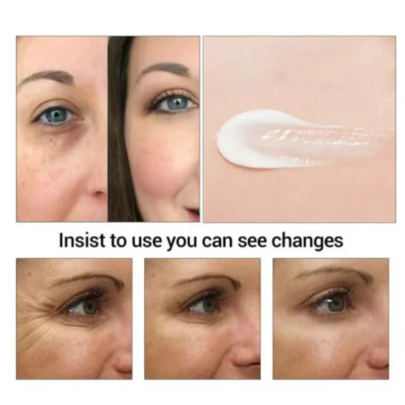 Crème pour les yeux anti-poches