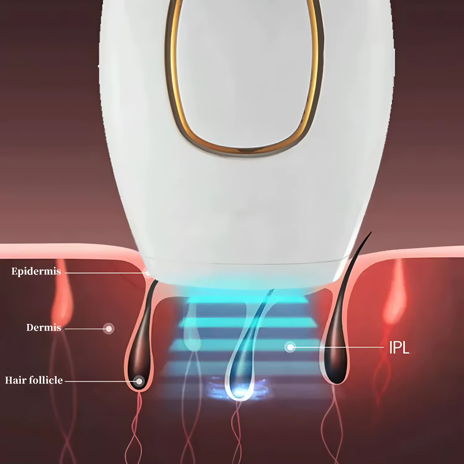 Épilateur laser IPL pour le corps et le bikini