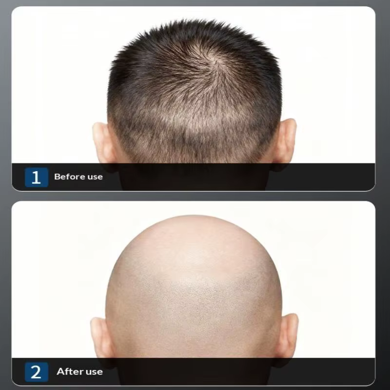 Rasoir manuel pour crâne chauve, coupe nette et précise, outil essentiel pour l'épilation et le toilettage.