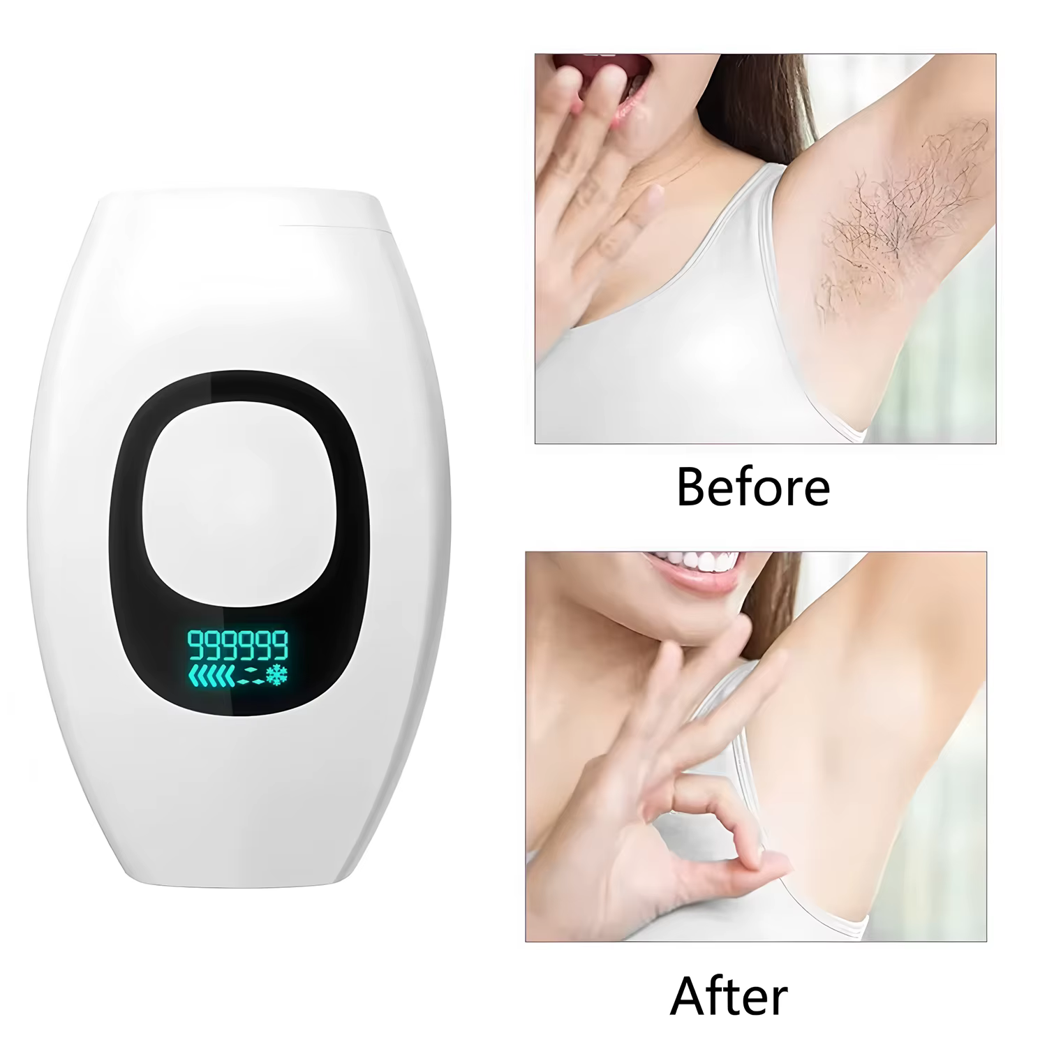 Épilateur laser permanent à affichage numérique IPL 500 000 impulsions pour femmes, appareil d'épilation à usage domestique