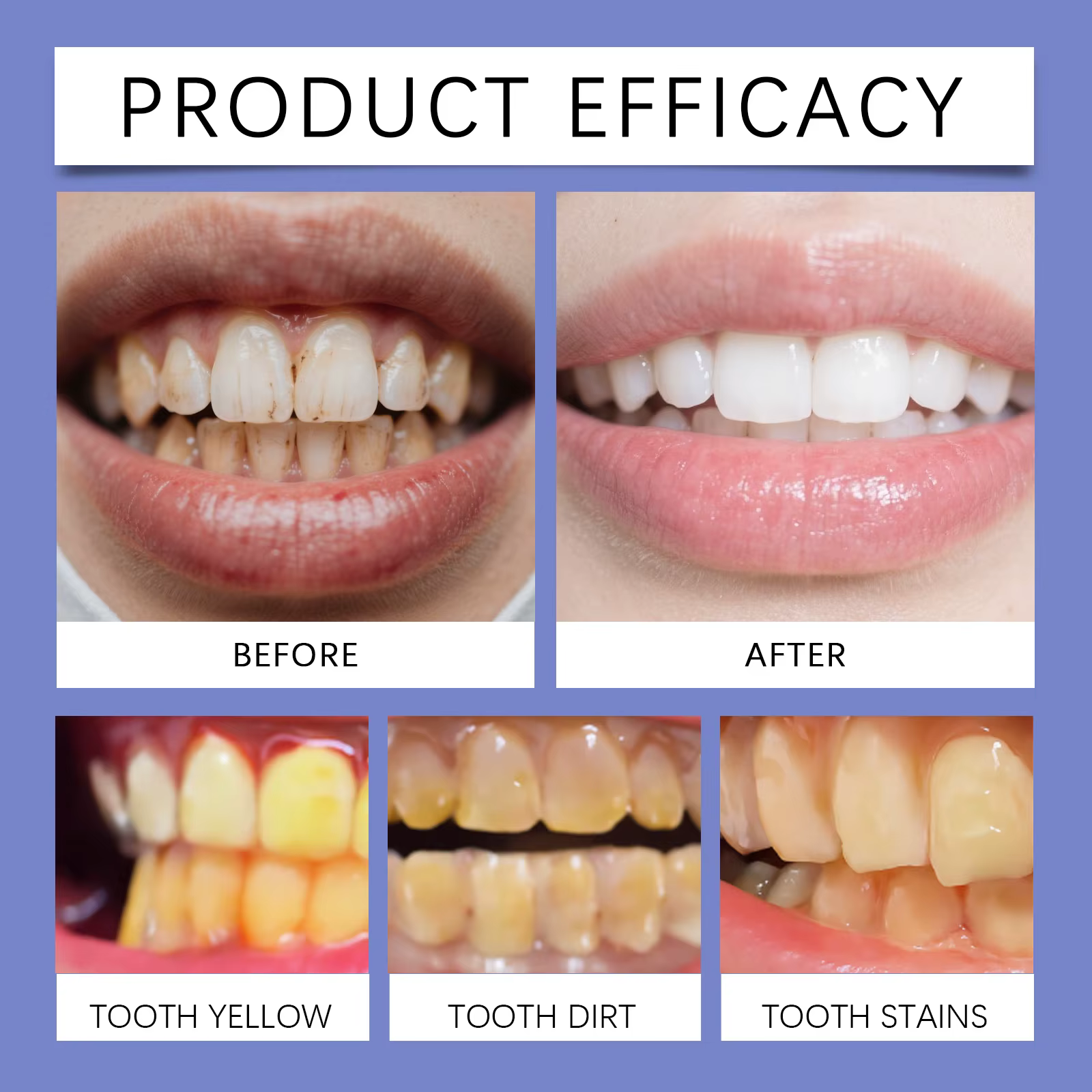 Dentifrice Blanchissant Avancé pour le Nettoyage des Dents, Apaise les Gencives, Haleine Fraîche Efficace, Soin des Gencives