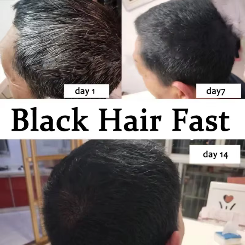 Sérum de traitement pour cheveux gris et blancs