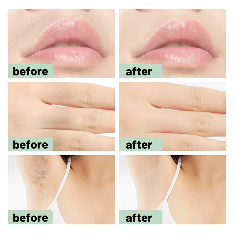 Bandes de cire pour le visage