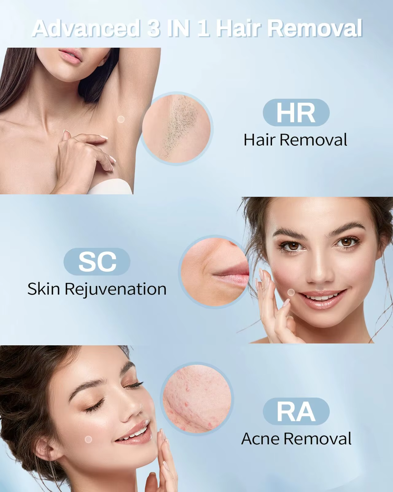 Dispositif d'épilation au Laser IPL 3 en 1