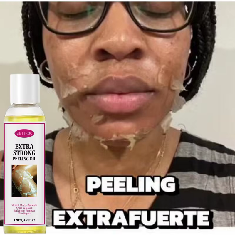 Huile exfoliante jaune, nettoyage doux, élimination des peaux mortes, sérum exfoliant pour le corps, hydratant, peau lisse et douce