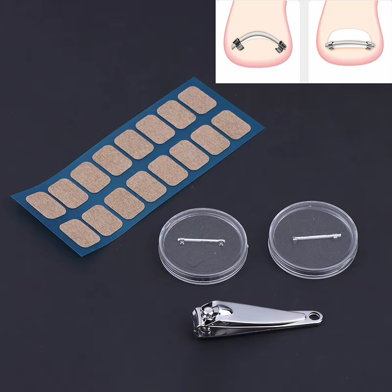 Correcteur d'ongles incarnés pour pédicure