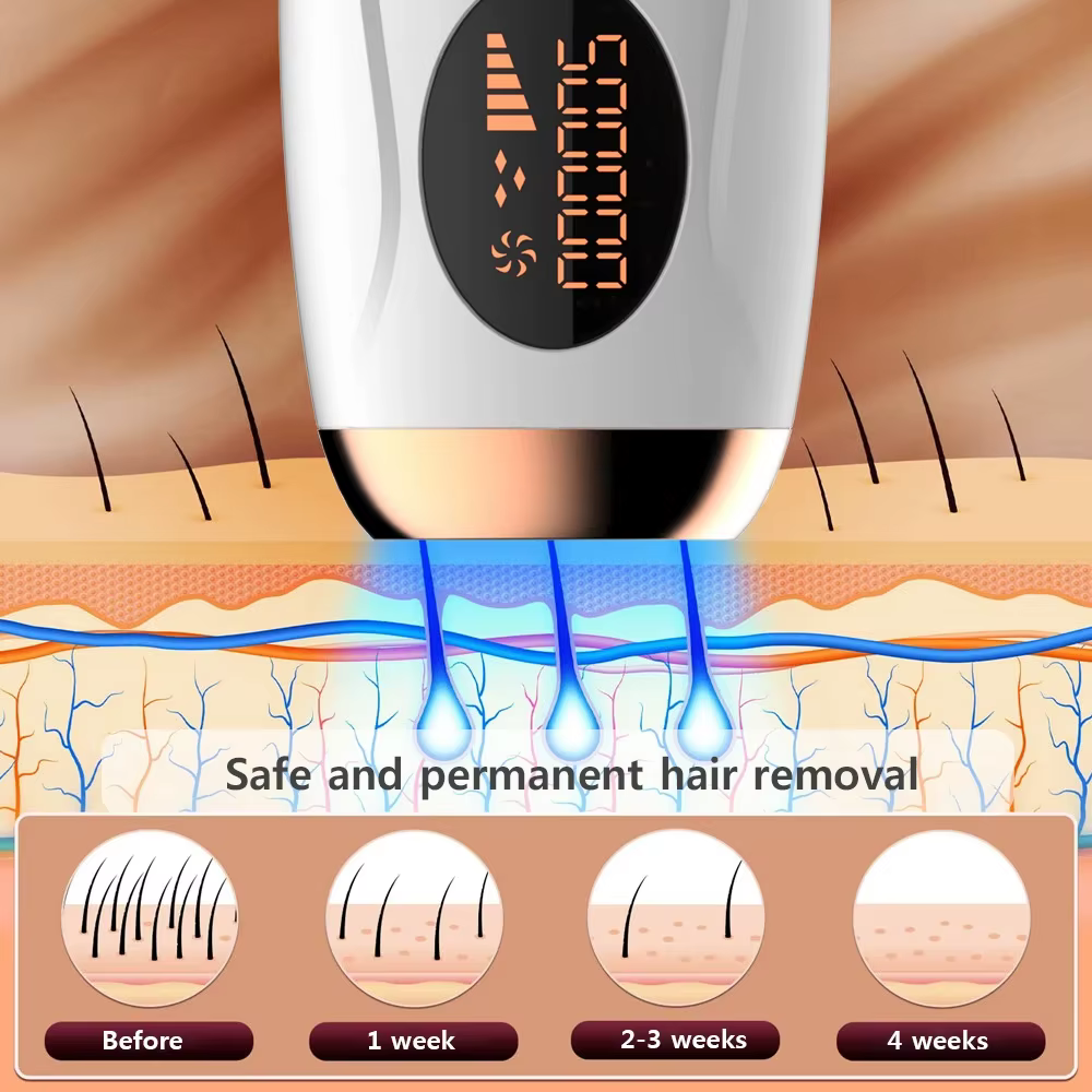 HOMEFISH Laser épilateur IPL épilation pour femmes corps Bikini visage 990000 flashs Permanent indolore IPL