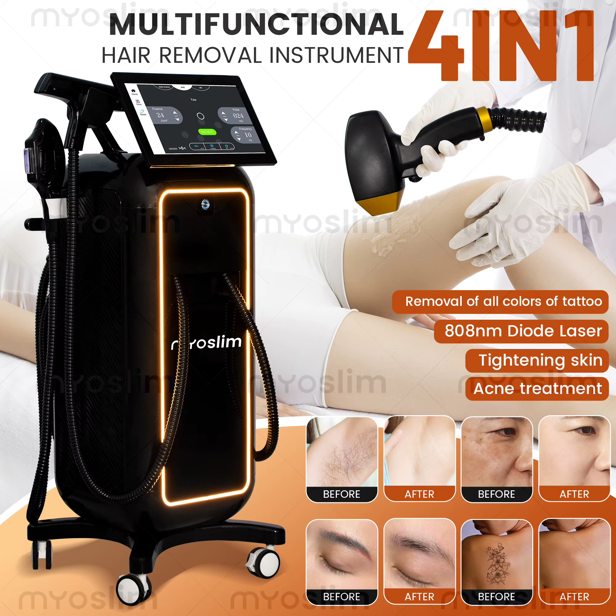 Appareil professionnel 4-en-1 à diode laser 4 longueurs d'onde 5000W 10 barres