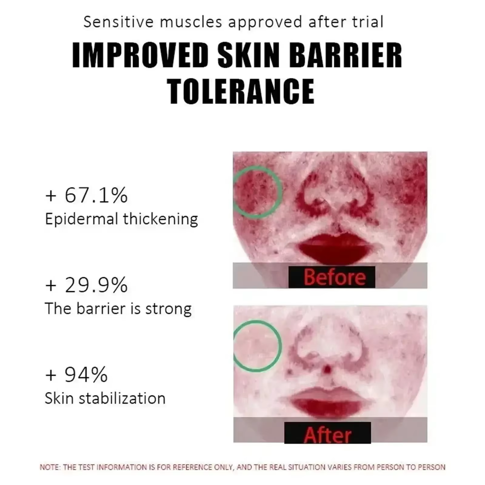 Crème réparatrice pour les rougeurs du visage